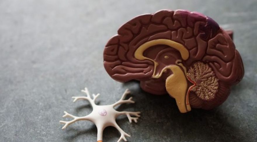 The Epstein-Barr Virus May Cause Multiple Sclerosis