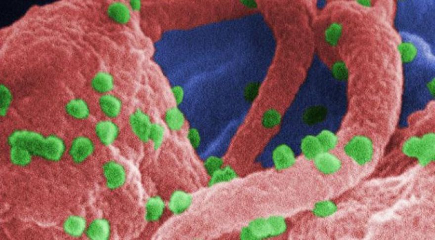 Chemically Custom-Tailored Graphene Could Diagnose HIV With Record Speed