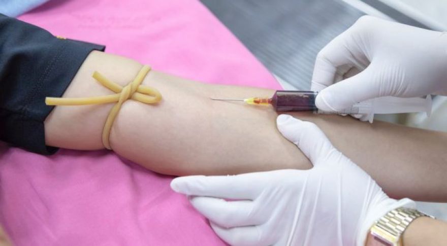 Researchers Create AI-Powered Blood Test to Detect Cancer