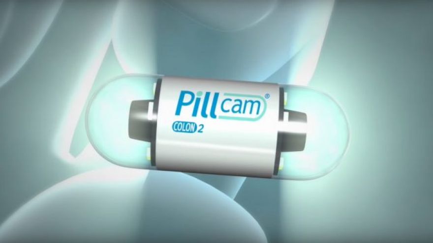 New PillCam Uses Wireless Radio, CCD Cameras to Diagnose Heartburn